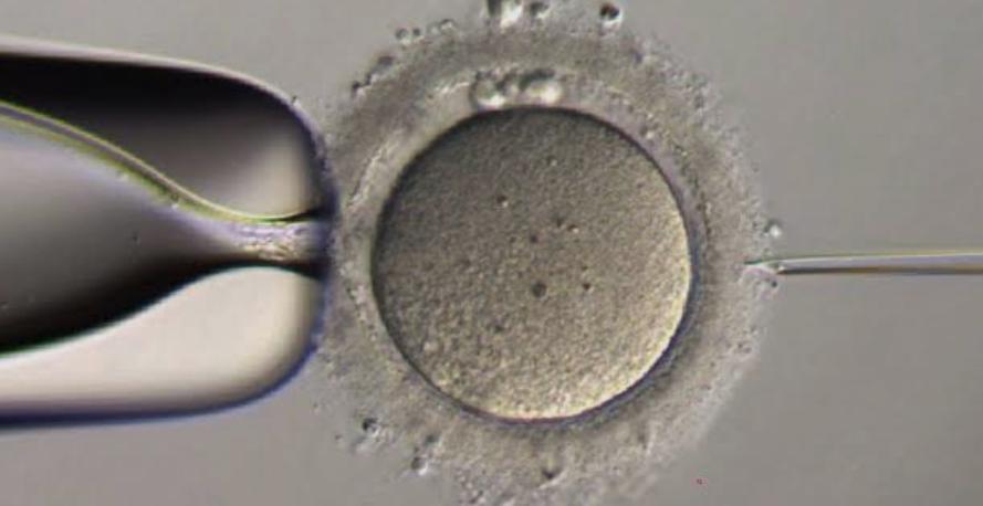 Understanding IVF: a guide for your journey