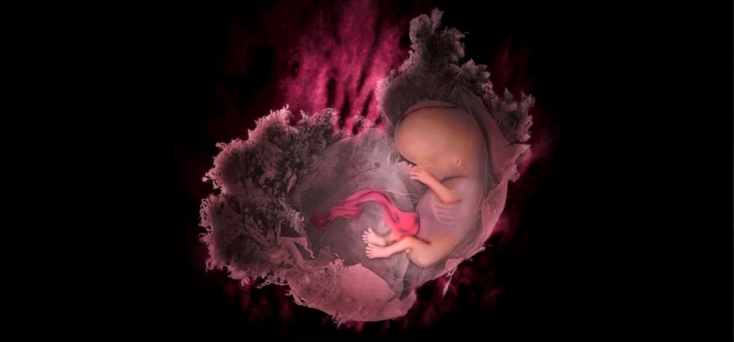Recurrent pregnancy loss